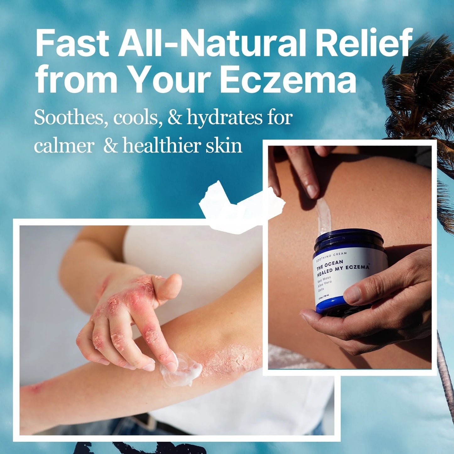 The Ocean Healed My Eczema™ - Soothing Cream