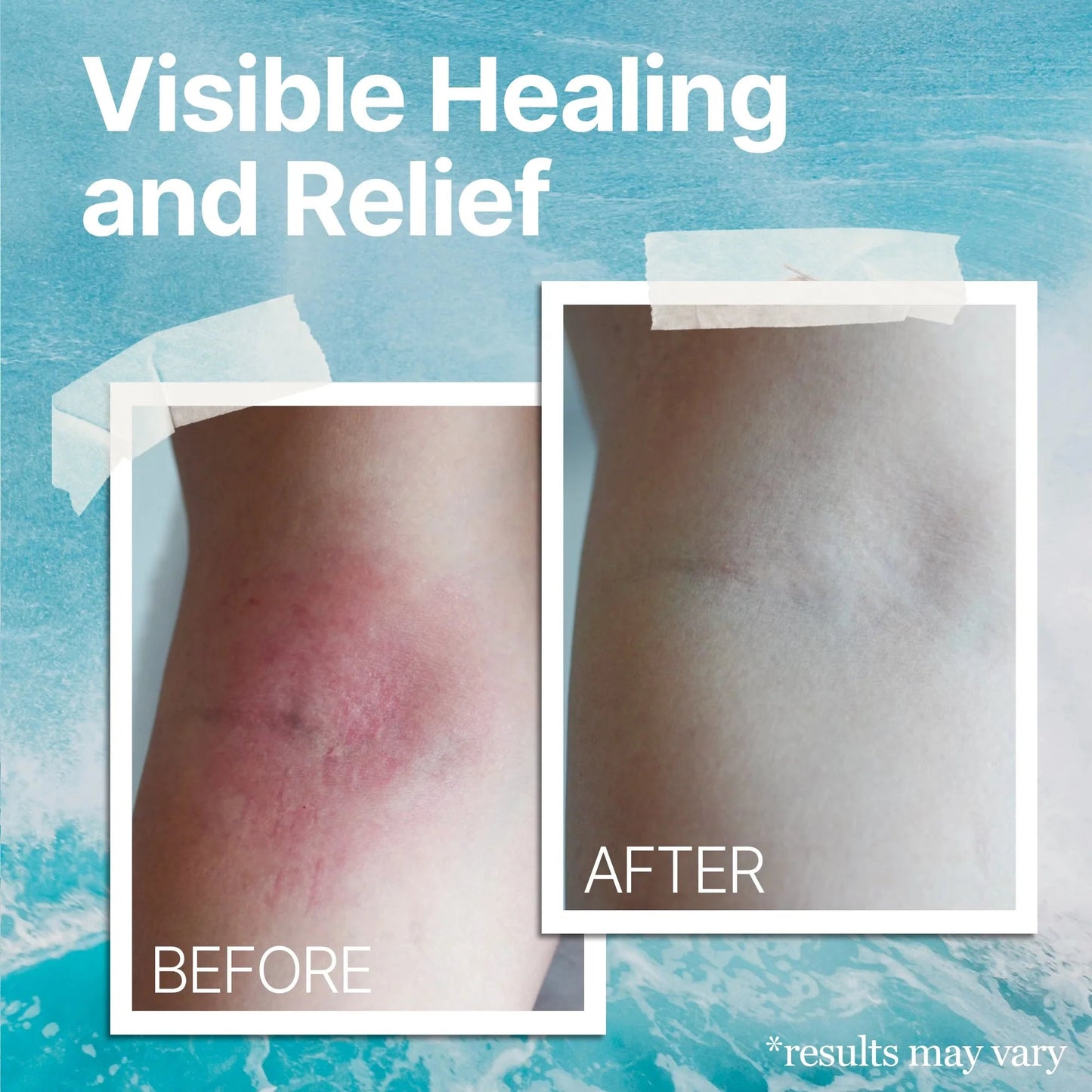 The Ocean Healed My Eczema™ - Soothing Cream